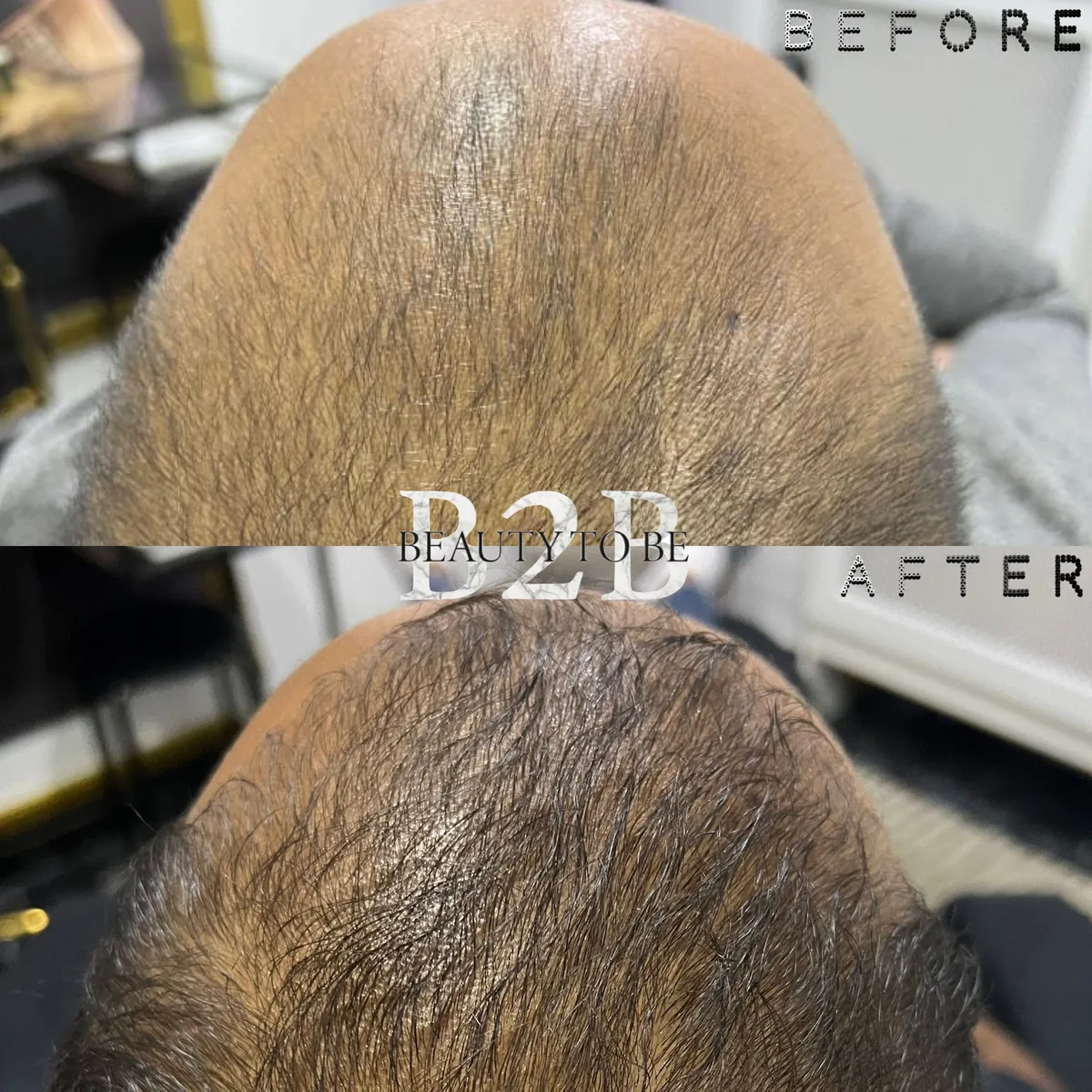 Haarresultaat 01: voor en na bij Beauty To Be